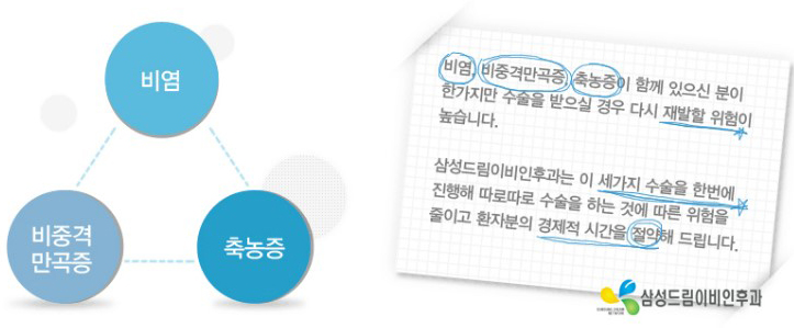 매부리코 성형