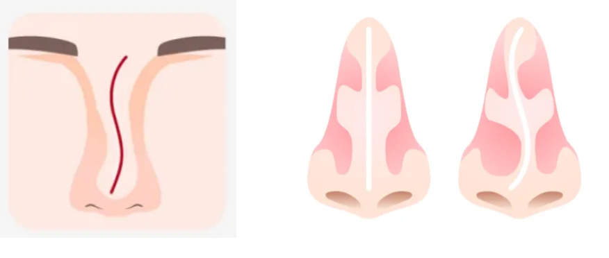 9r6xPtVTUa7vBz50_20251212.png