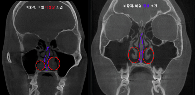 삼성드림이비인후과
