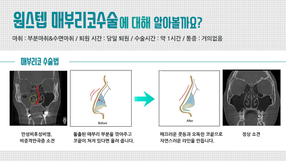 삼성드림이비인후과